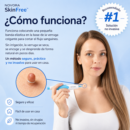 SkinFree | Kit Removedor de Verrugas Colgantes